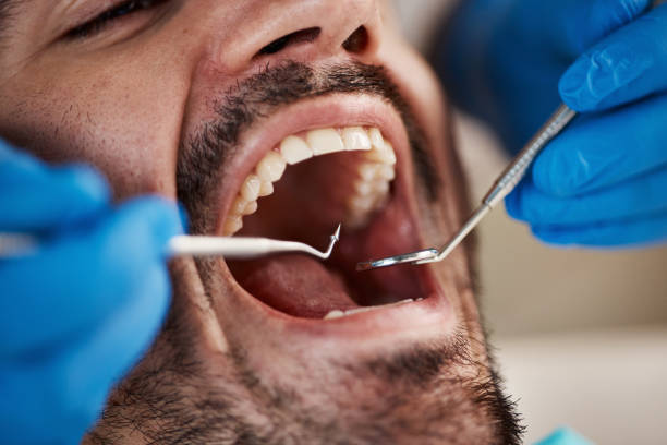 Best Emergency Treatment for Dental Infections or Abscesses in Ocean Ridge, FL